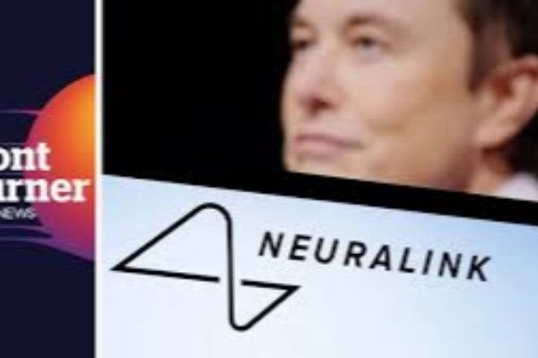 Neuralink மூளைச் சிப் - 100 நாட்கள் அனுபவம் பகிர்ந்த நோலண்ட் ஆர்பா