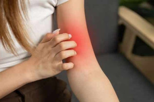 தோல் அரிப்பு  ஏற்படுவதற்கான காரணம்  தெரியுமா?