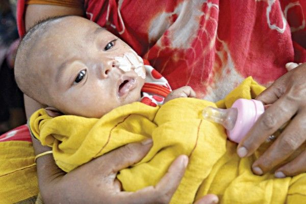 பங்களாதேஷில் அம்மை நோயால் 8 மாத குழந்தை உயிரிழப்பு