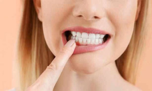 பற்களை பாதுகாக்க எளிய வழிகள்