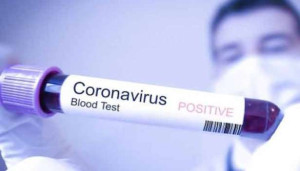 இலங்கையில் கொவிட் தொற்று பரவல் தீவிரம் - இருவர் பலி