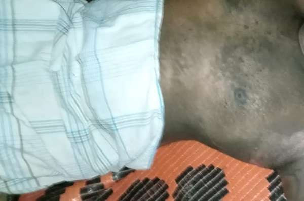 யாழில் எரியூட்டப்பட்ட நிலையில் நபர் ஒருவர் மீட்பு