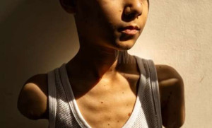 இஸ்ரேலின் தாக்குதலில் இரண்டு கைகளையும் இழந்த சிறுவனின் புகைப்படம்