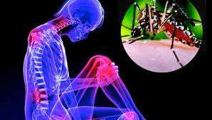 சீனாவில் வேகமாக பரவும் சிக்குன்குனியா நோய் பாதிப்புகள்!