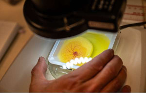 புற்று நோய்க்கு புதிய சிகிச்சை முறையை கண்டு பிடித்த கனடிய ஆய்வாளர்கள்