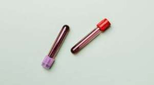 கருச்சிதைவு ஏற்பட்ட பெண்ணின் உடலில் ஆண் குரோமோசோம்கள் - அதிர்ச்சி தகவல்