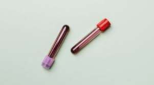 கருச்சிதைவு ஏற்பட்ட பெண்ணின் உடலில் ஆண் குரோமோசோம்கள் - அதிர்ச்சி தகவல்