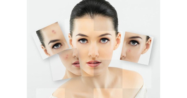 முகப்பரு வந்தால் செய்யக் கூடாதவை