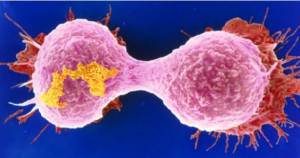 புற்றுநோய்: தவறான பழக்கங்களால் வருகிறதா? தானாகவே வருகிறதா?