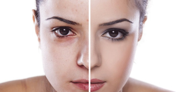 முகத்தில் உள்ள அழுக்கை போக்கும் இயற்கை வழிகள்