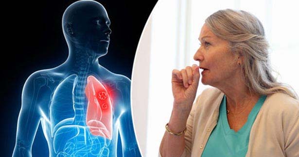 நுரையீரல் சம்பந்தப்பட்ட நோயின் அறிகுறிகள்